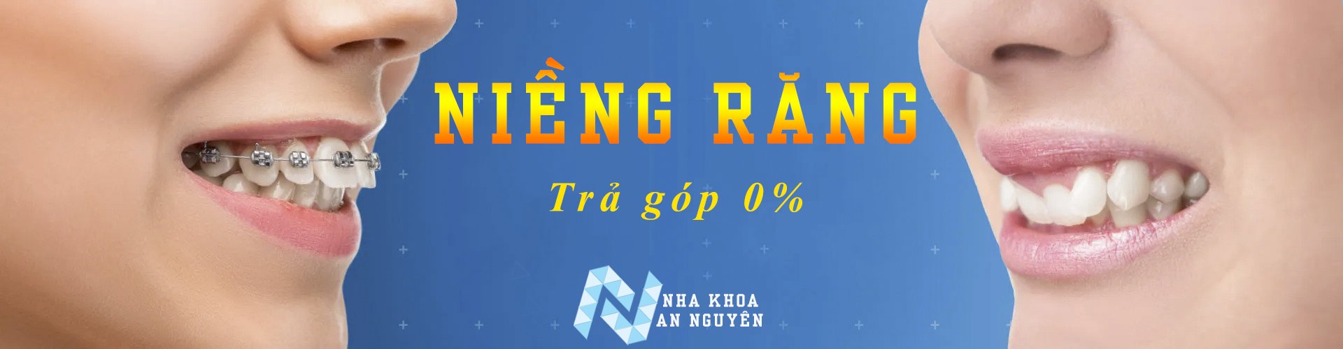 Nha khoa An Nguyên